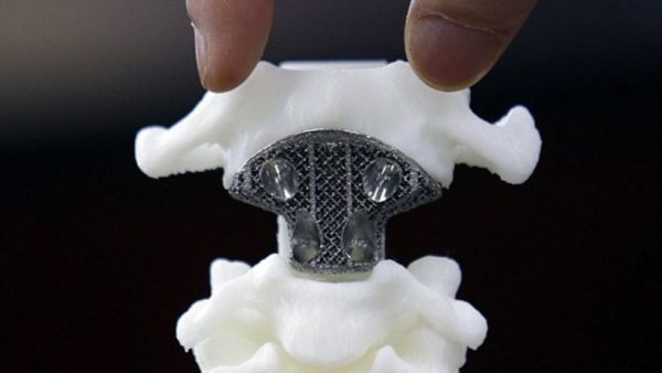Image 1 : Après le crâne, voici la vertèbre imprimée en 3D